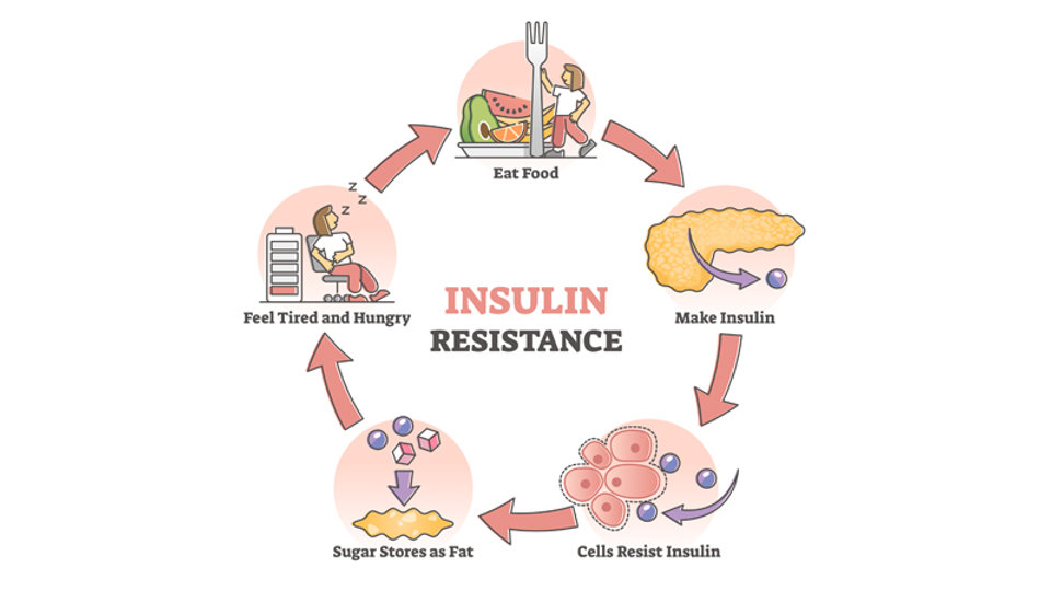 Insulin Resistance 101: What Is It and Can It Be Reversed?
