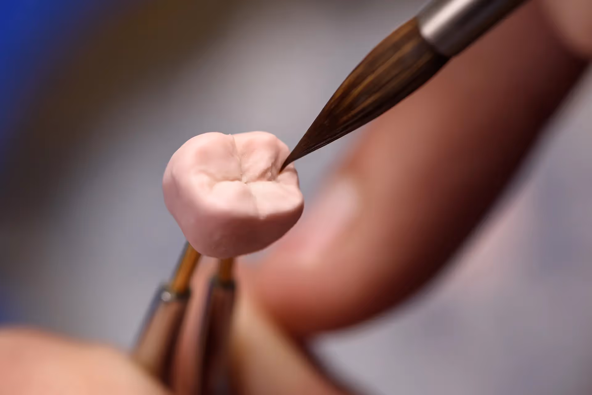 Implant Crowns in Cincinnati in Canton, GA | Hubbell J. Smith, DDS