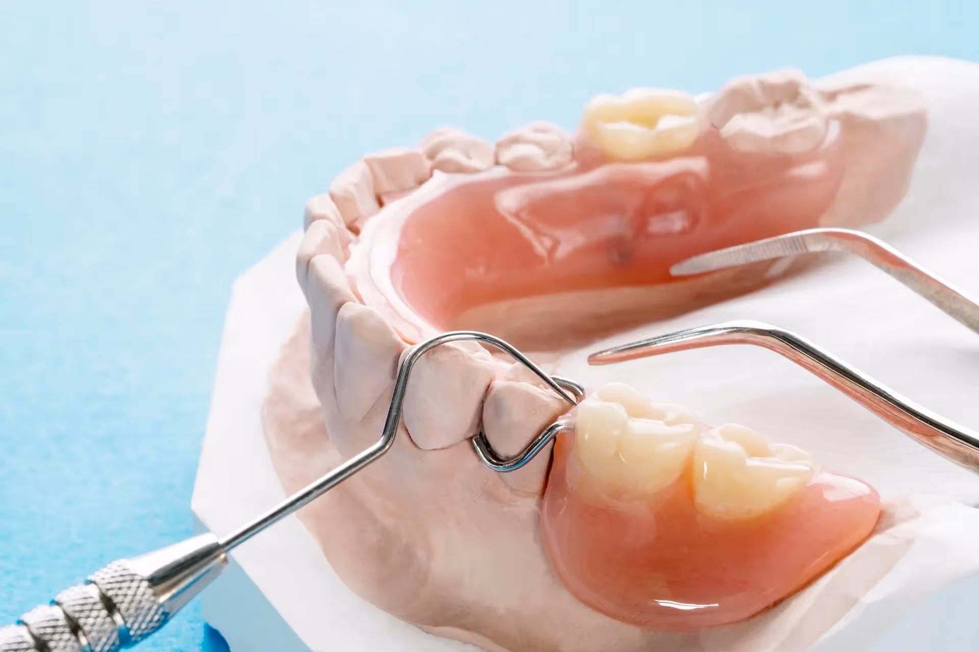 Partial Dentures in Cincinnati | Hubbell J. Smith, DDS