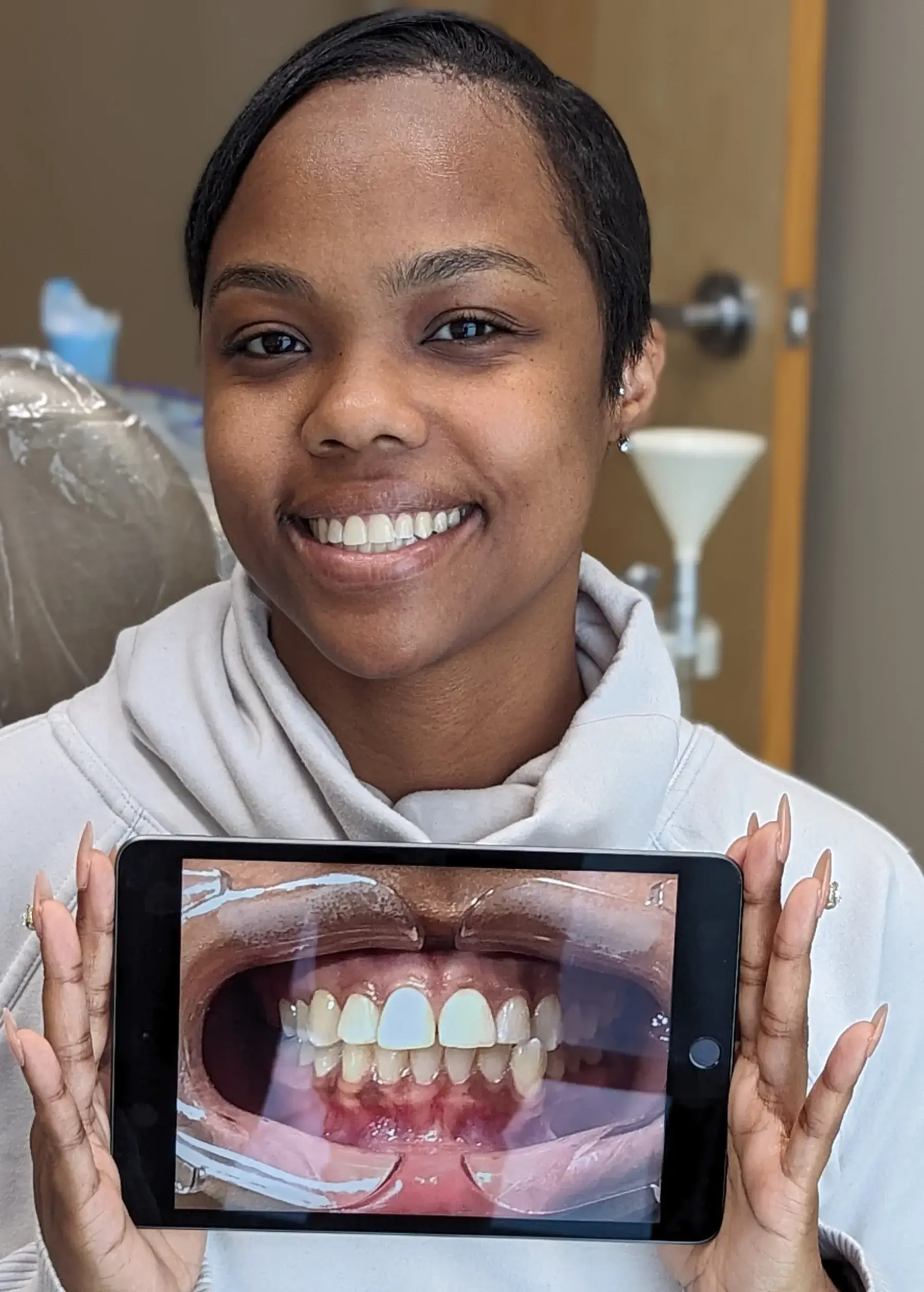 A woman smiling holding a picture of her previous smile.