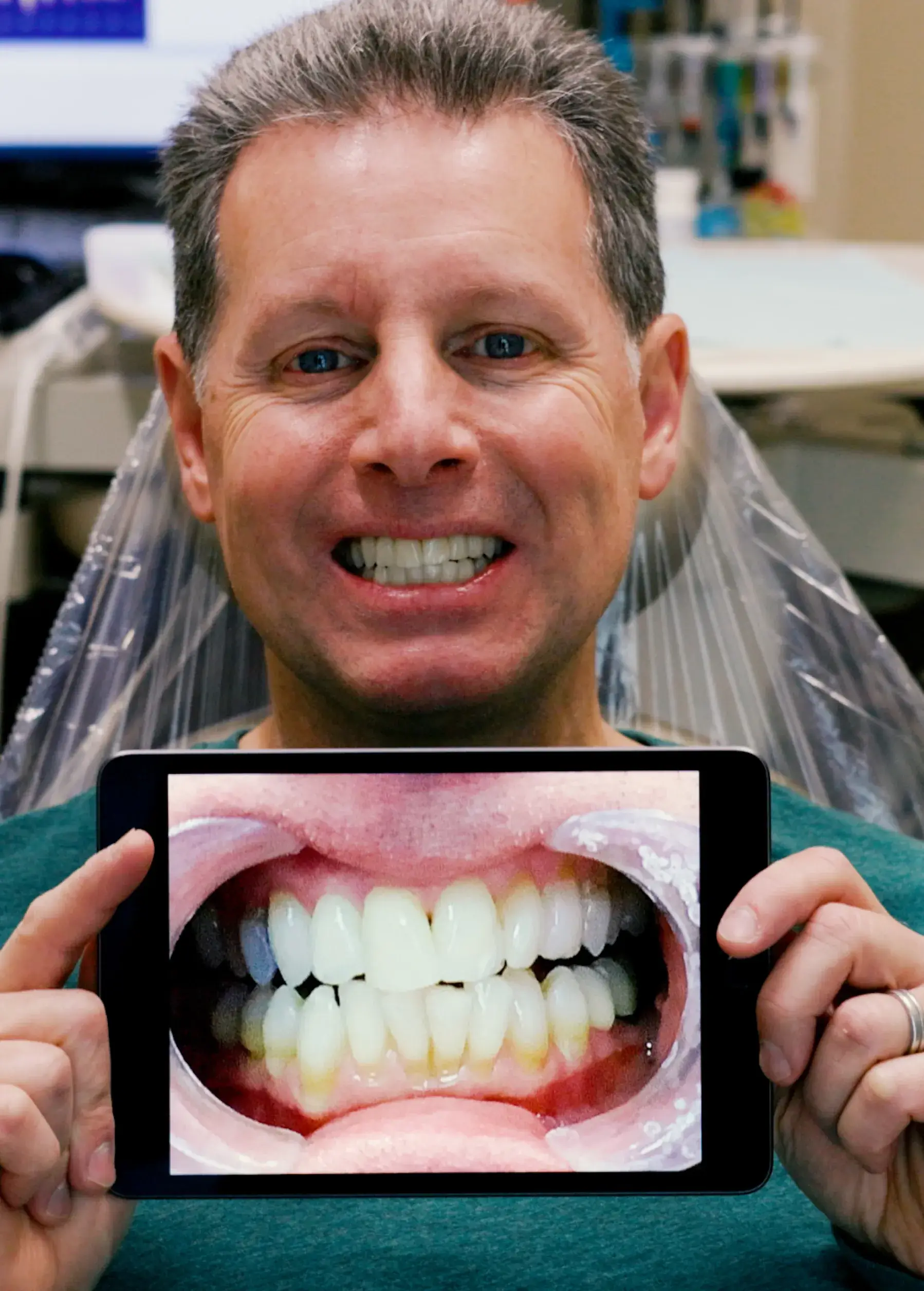 A man smiling holding a picture of his previous smile.