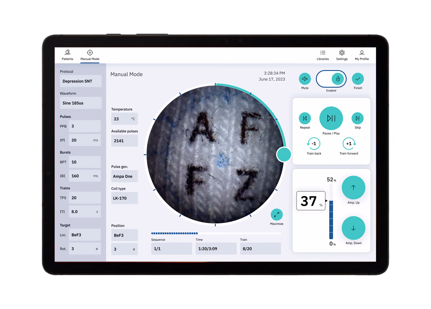 Tablet screen showing manual mode interface with brain scan labeled AF, depression protocol, and pulse settings.
