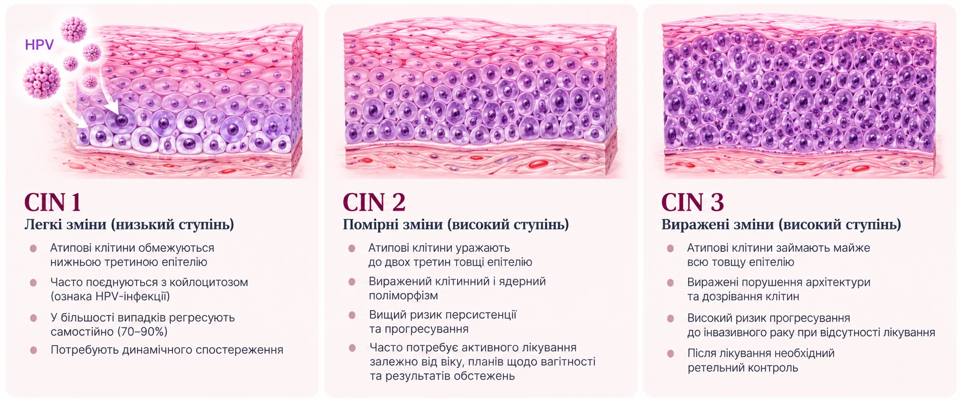 Ступені дисплазії CIN 1, CIN 2 і CIN 3