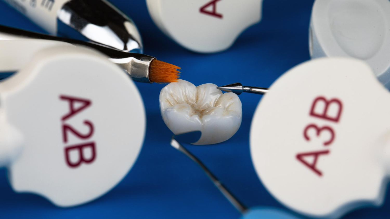 Préskerámia és kompozit betétek