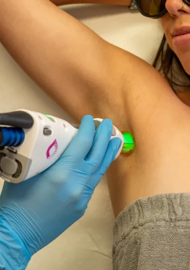 Close-up of a person wearing sunglasses receiving laser treatment on their underarm by a gloved hand.
