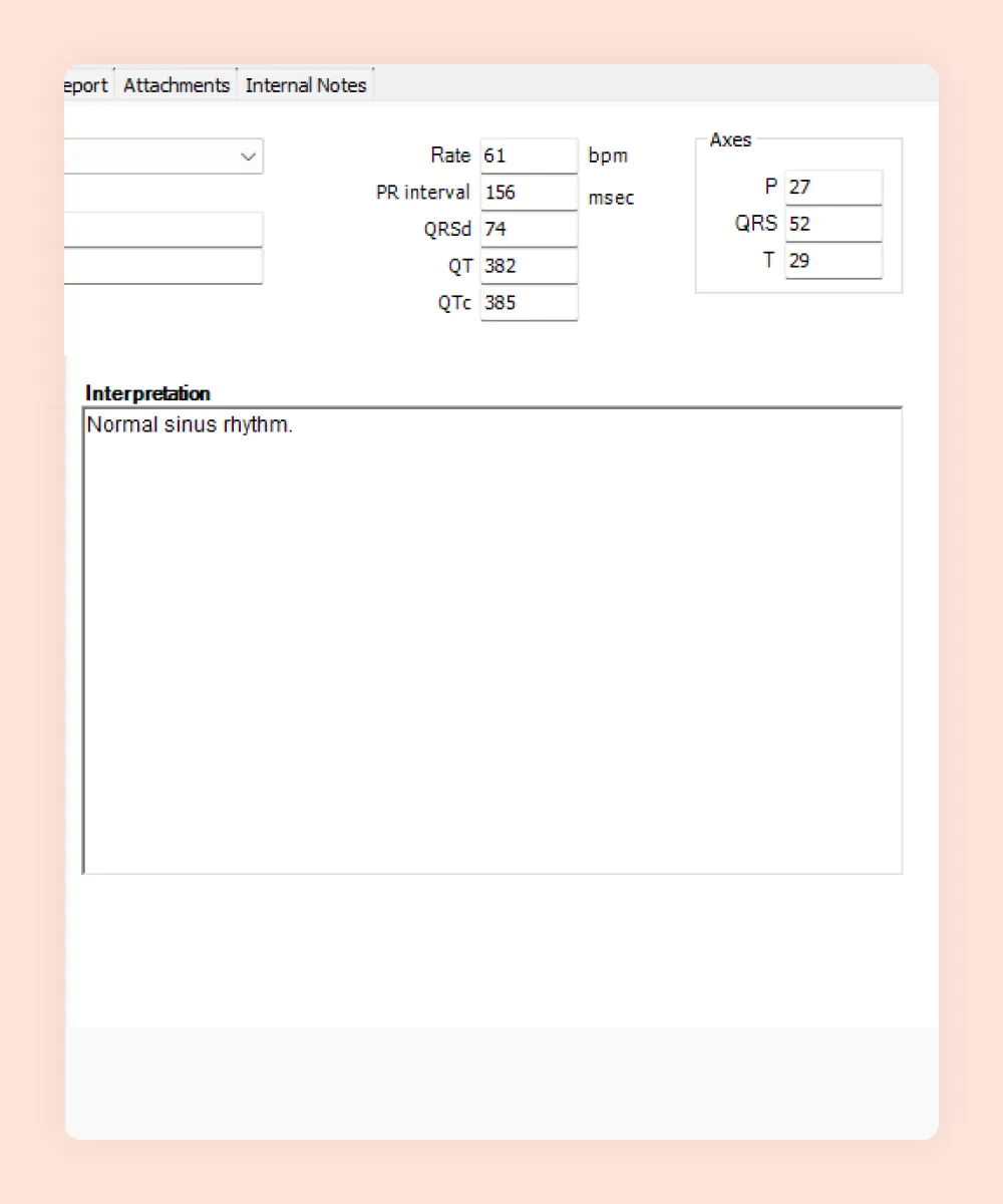HealthTrack ECG reporting showing rate, PR interval, QRS duration, QT and QTc with the clinician's interpretation