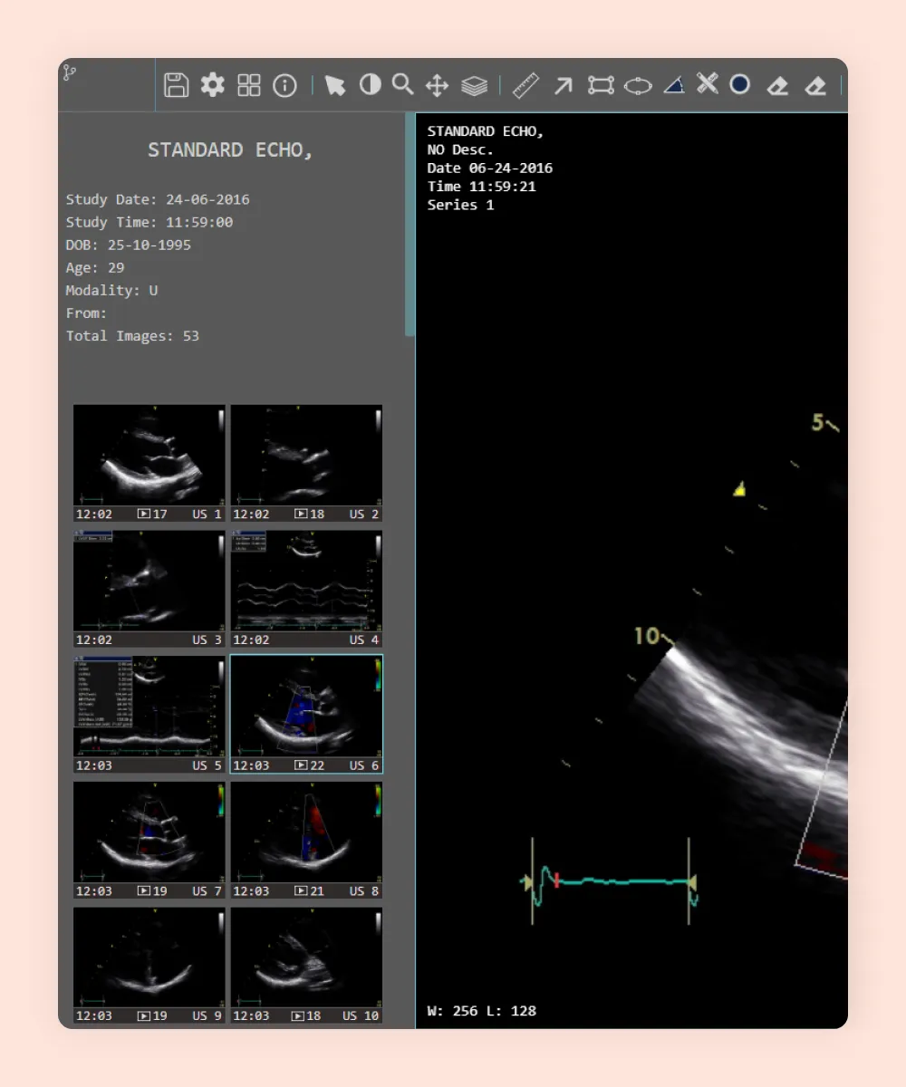 HealthTrack DICOM viewer showing a standard echocardiogram study with 53 images and an ultrasound loop enlarged