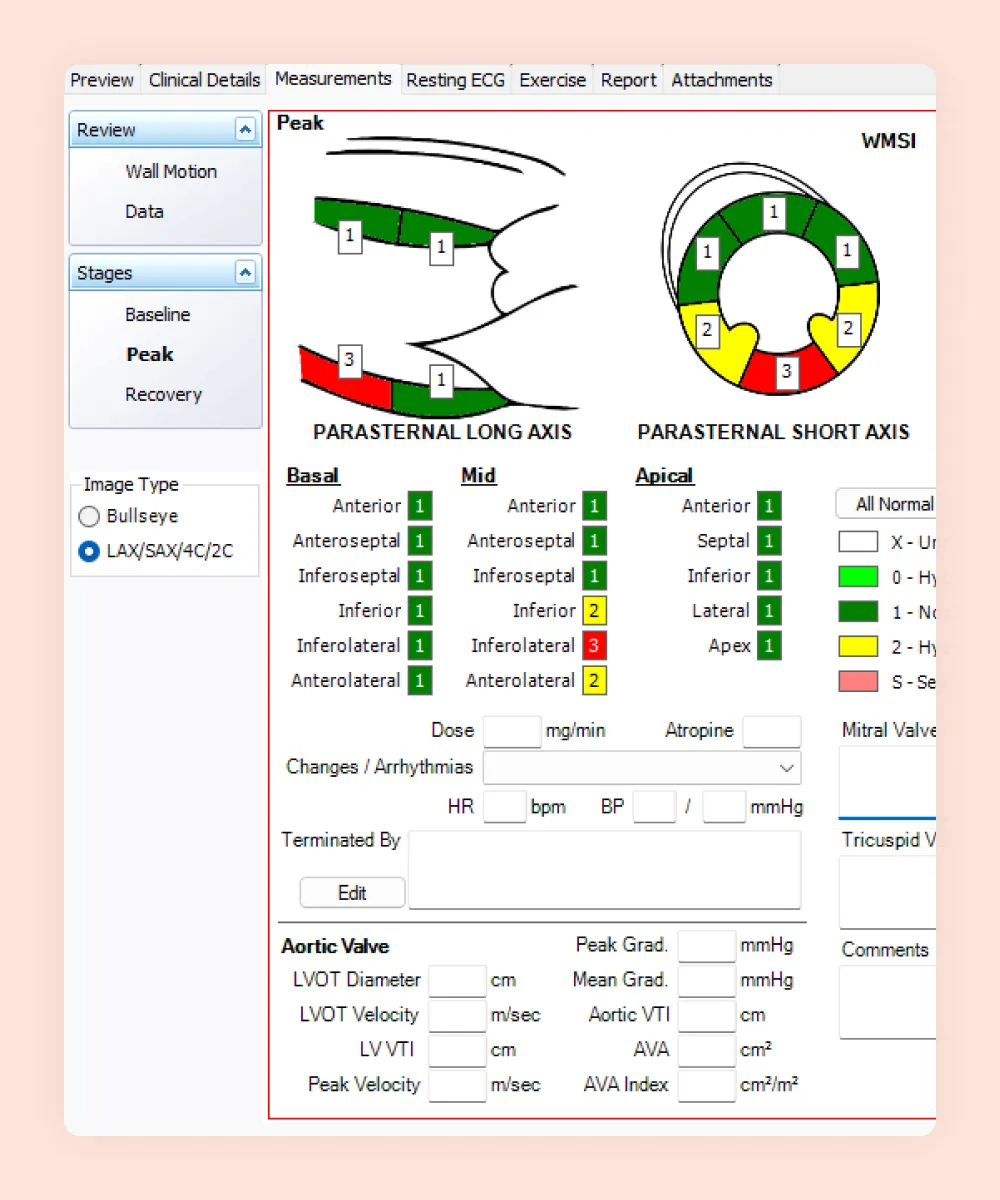 HealthTrack stress echo reporting, scoring wall motion by segment on parasternal long and short axis diagrams