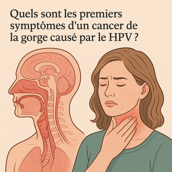 Quels sont les premiers symptômes d'un cancer de la gorge causé par le HPV ?