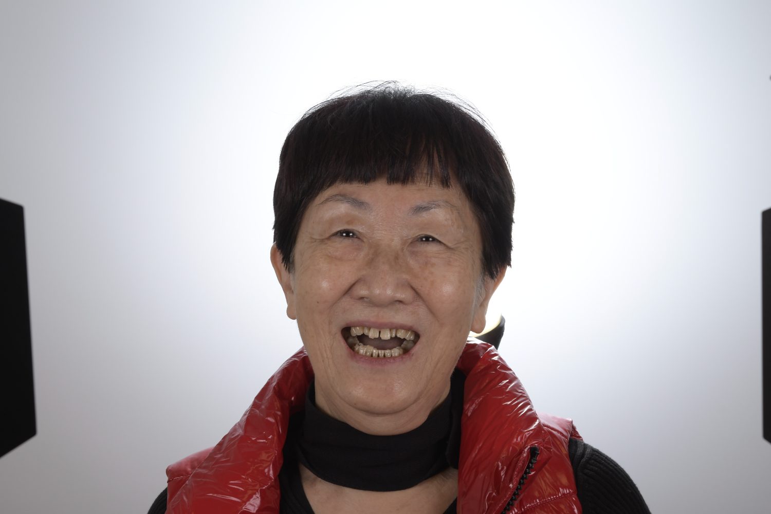 Printed full mouth before portrait
