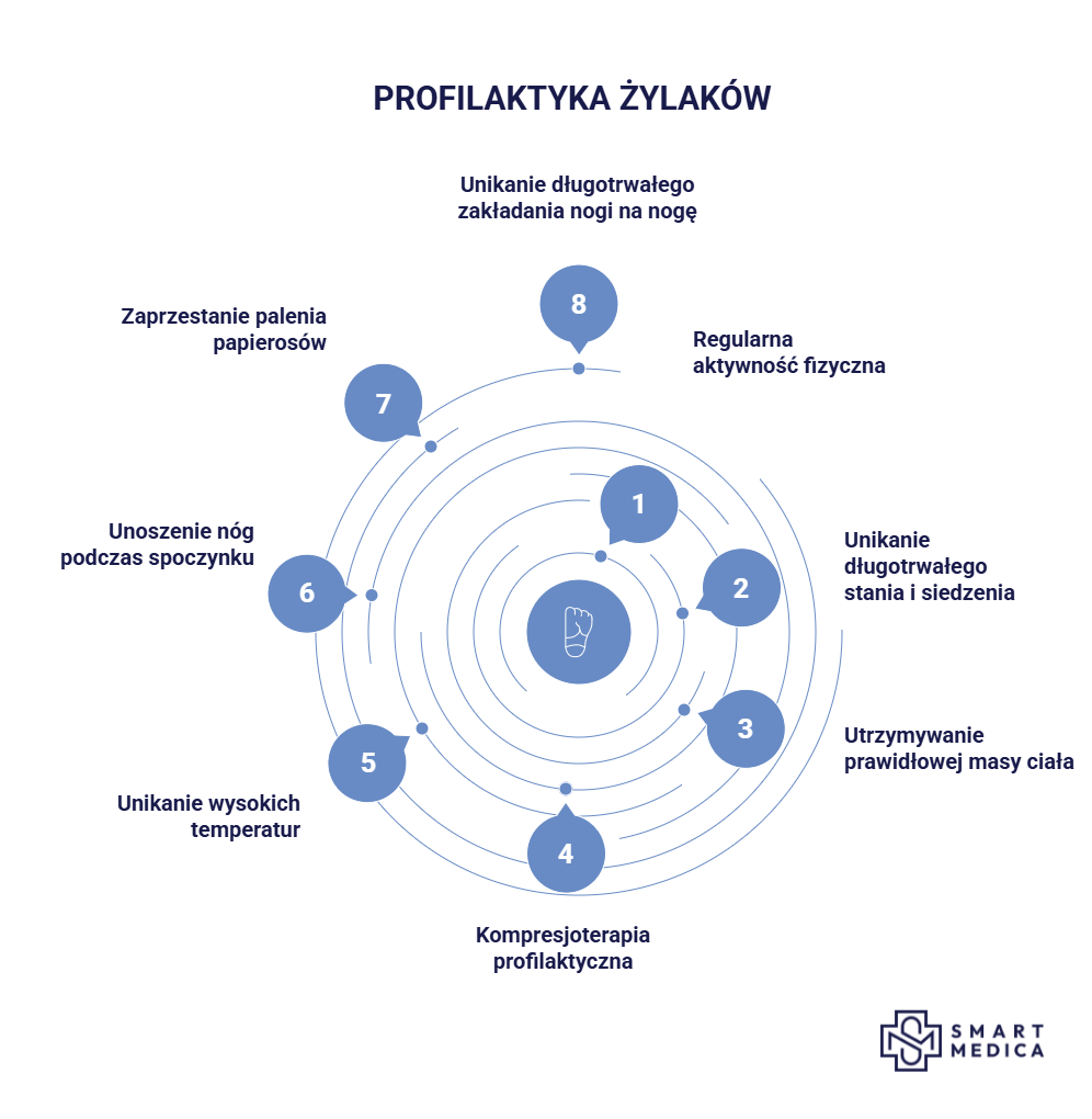 Profilaktyka żylaków - infografika