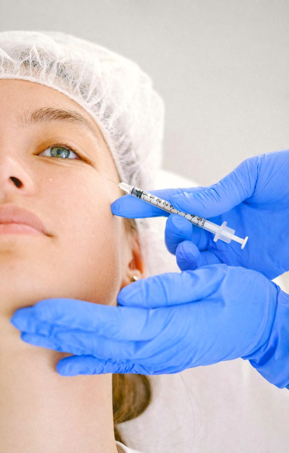 Zabieg botoksu na twarz w Smart Medica