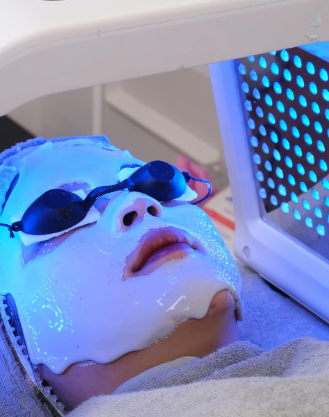 Blue Light Acne Therapy