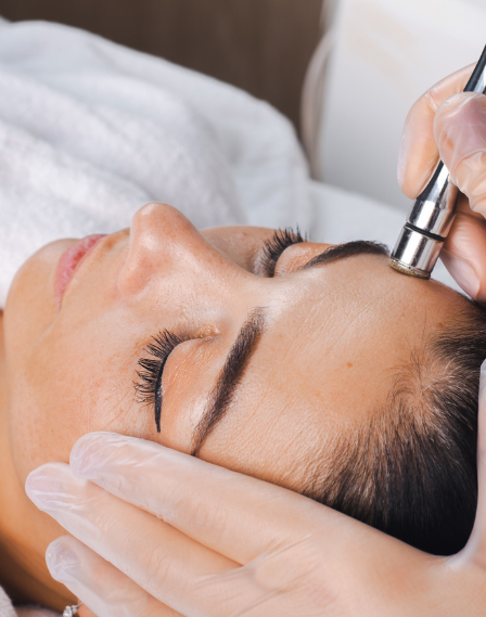Micro Needling/Extraction
