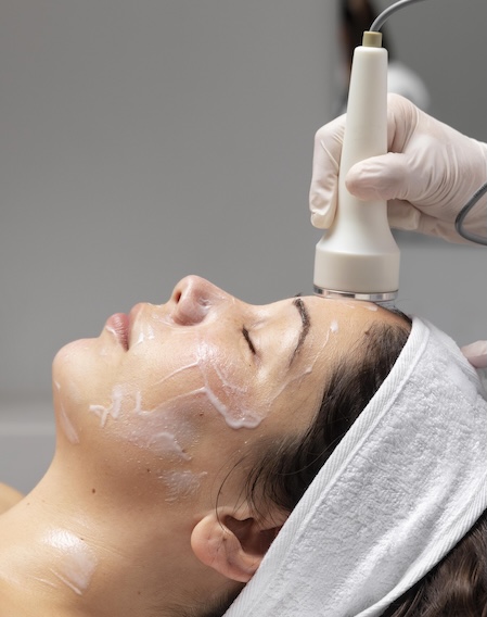 Microdermabrasion