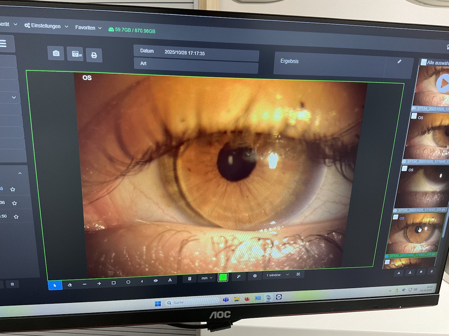 Ein Auge in Nahaufnahme auf einem Monitor nach einem Augenscan