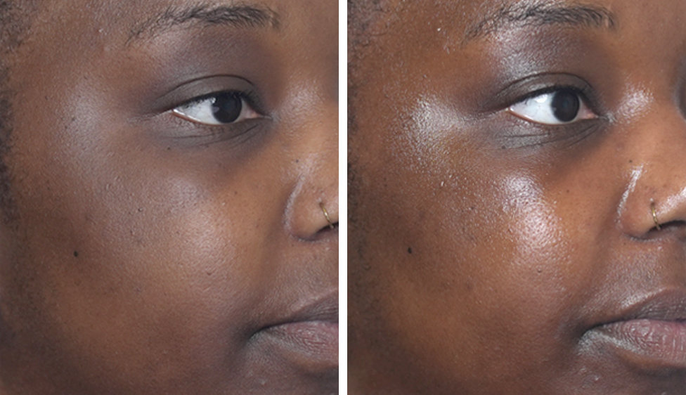 Close-up of a person's face showing a side-by-side comparison of skin texture. The left side appears matte, while the right side looks glossier and more radiant.