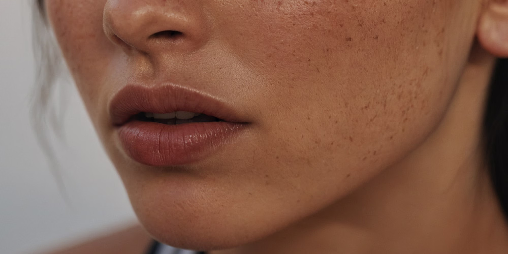 A close-up of a woman's lips and cheek showing a natural complexion with visible freckles.