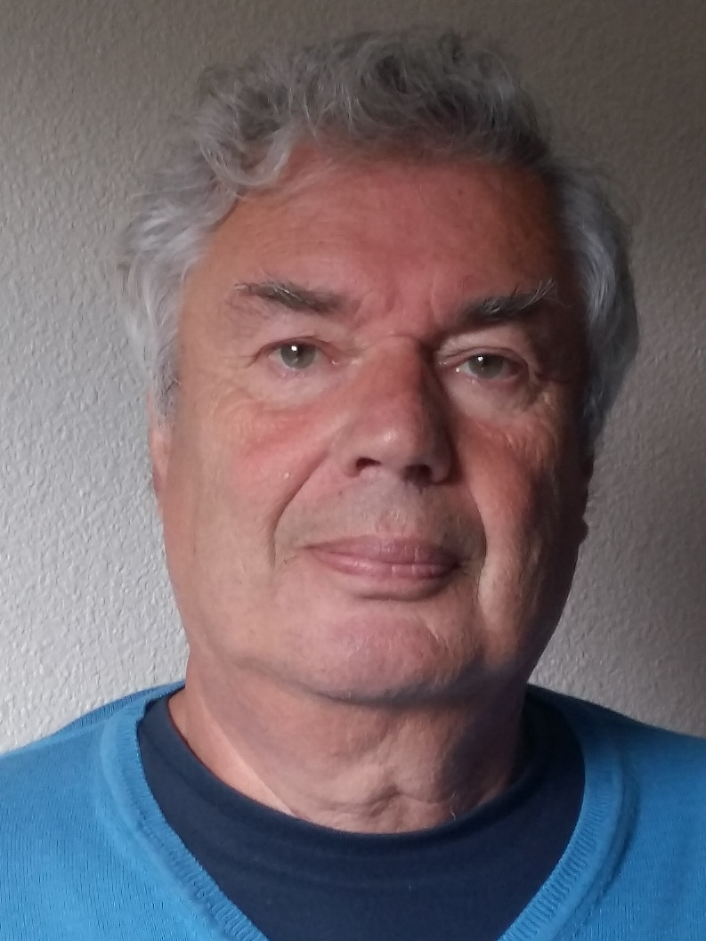 Pierre Robin