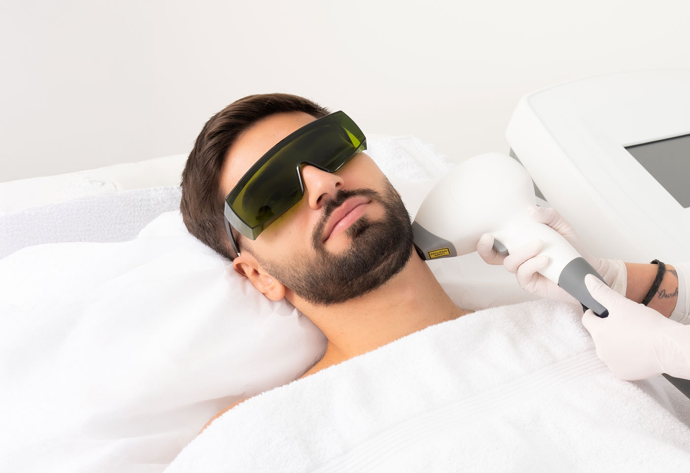 Haarentfernung Laser Mann