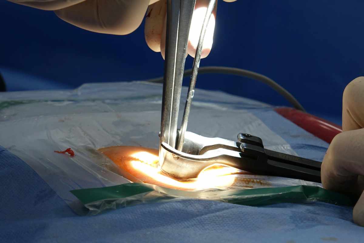 gynecological procedures