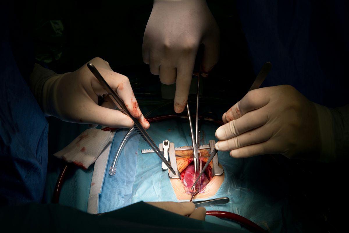 gynecology surgery