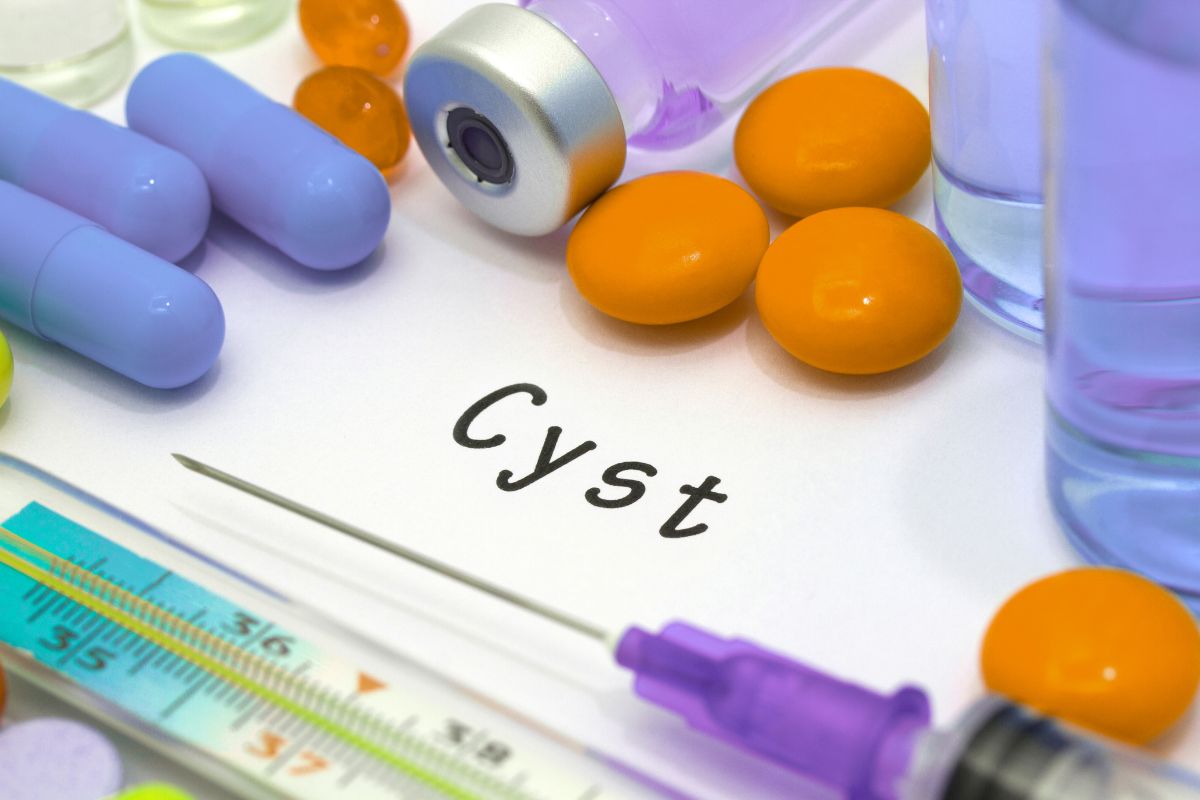 cyst spelled out