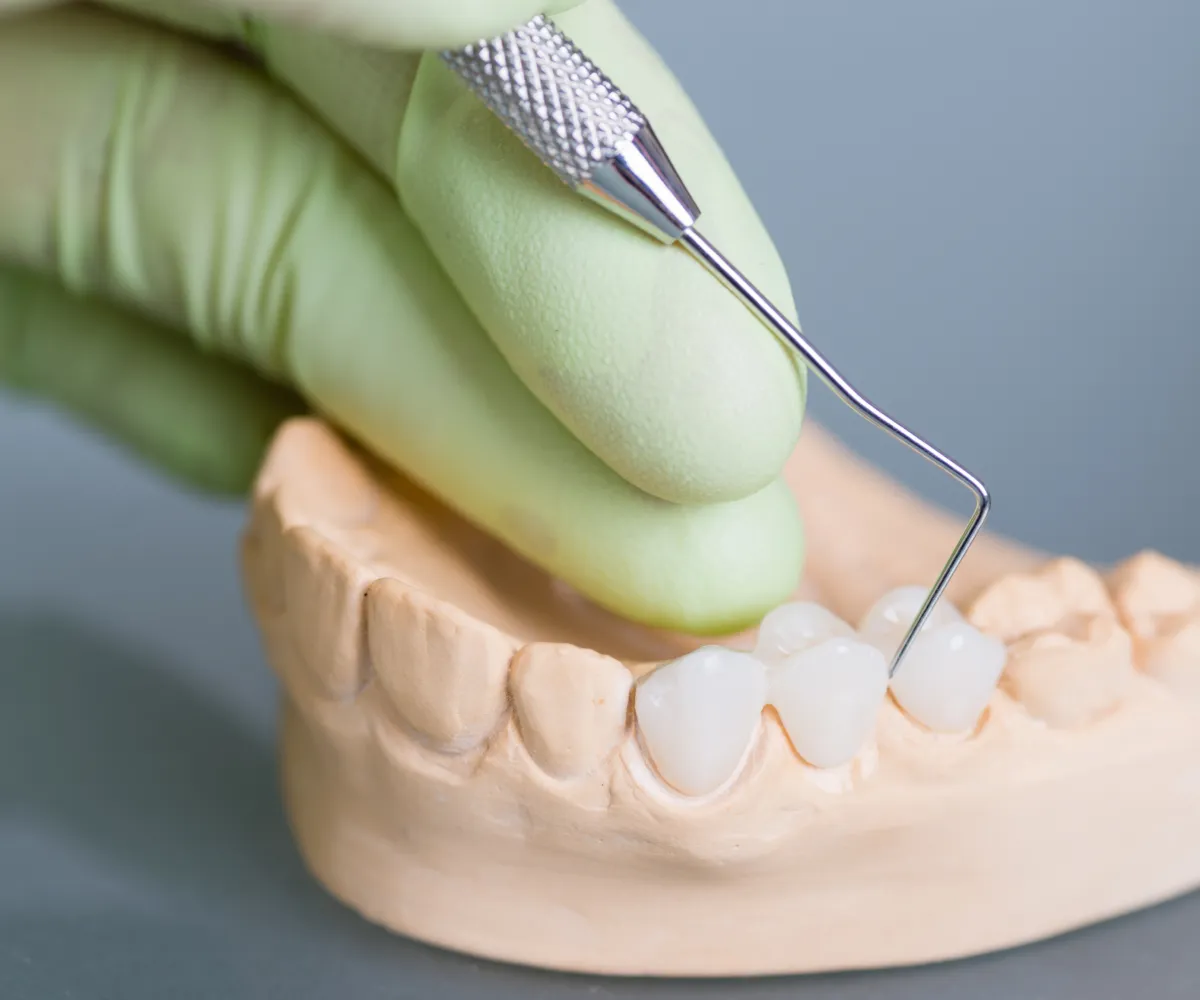 A gloved hand holds a dental tool, examining a model of human teeth.