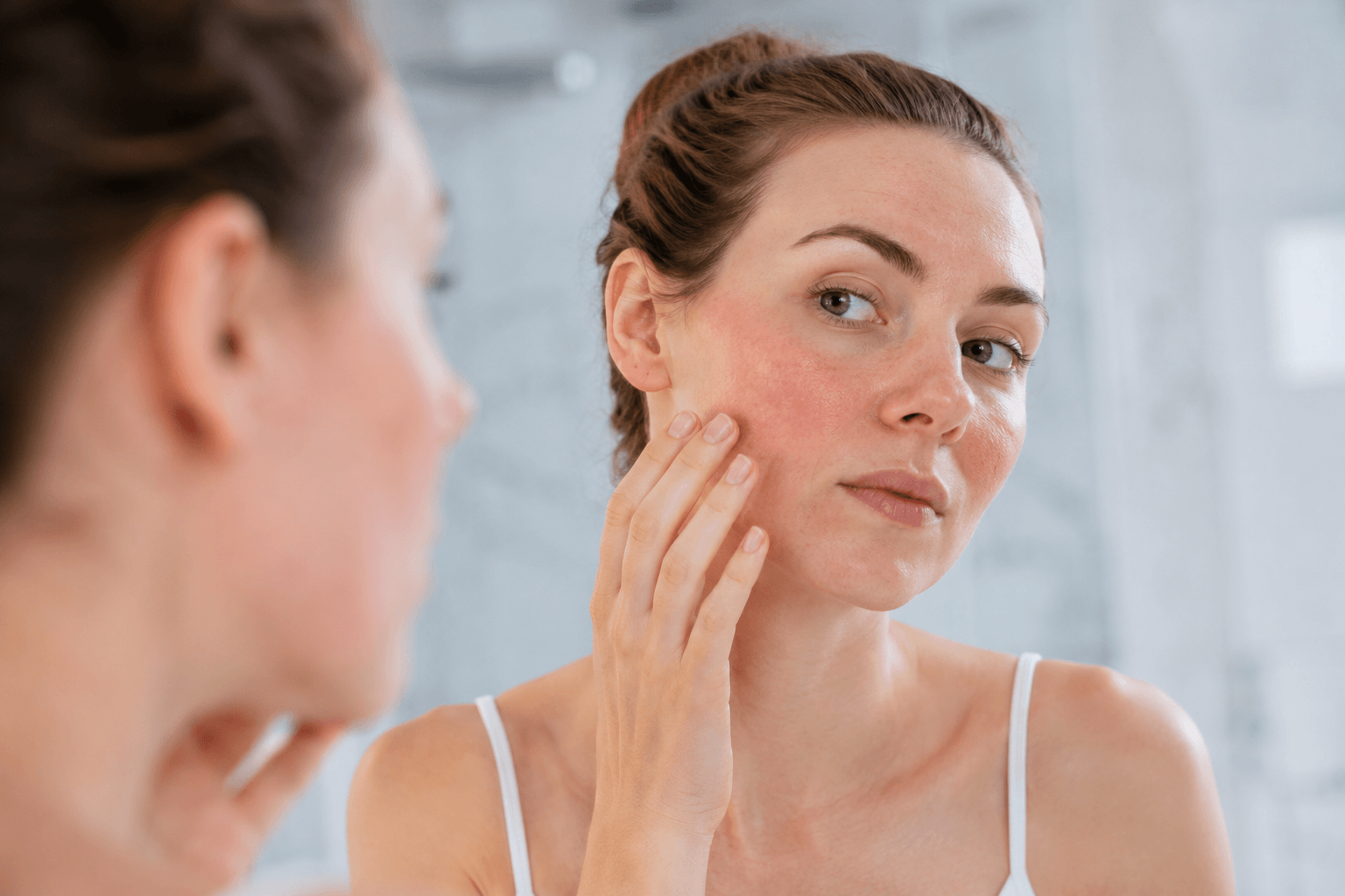 Woman with persistent facial redness receiving a professional rosacea skin consultation at Shorrbeauty in Costa Mesa, California.