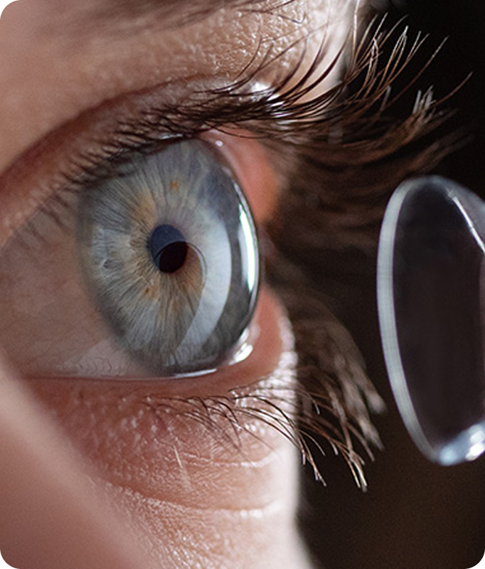 a cutting-edge scleral lens 