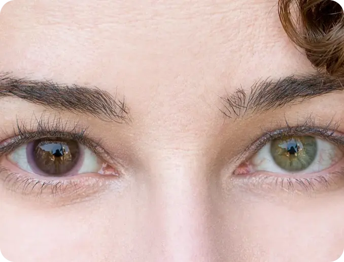 transitions contacts