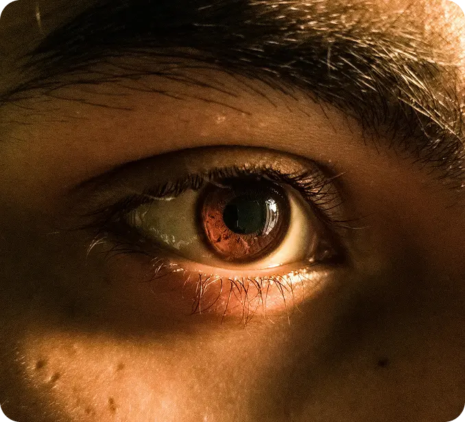 Close-up of a brown eye with detailed iris and surrounding skin in warm lighting.