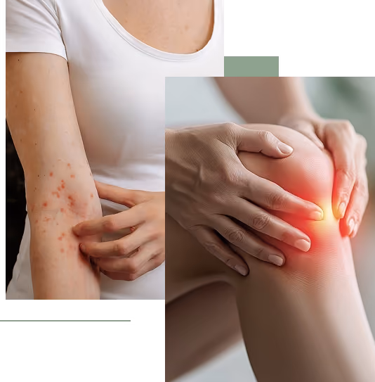 Autoimmune Disorders Services in Bingham Farms
