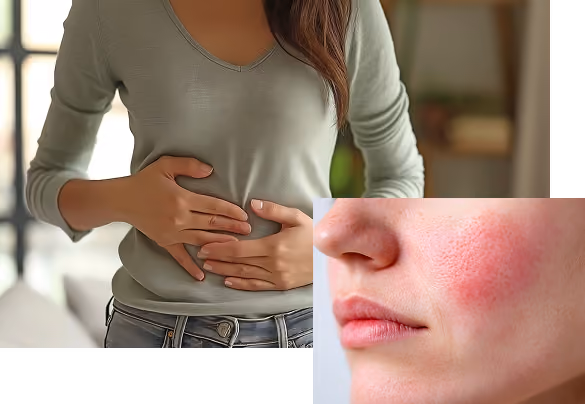 Digestive Issues