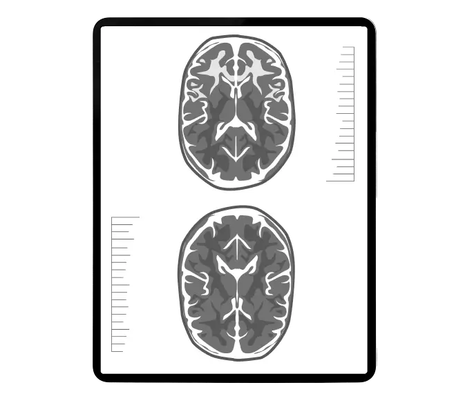 An illustration of a brain mri.