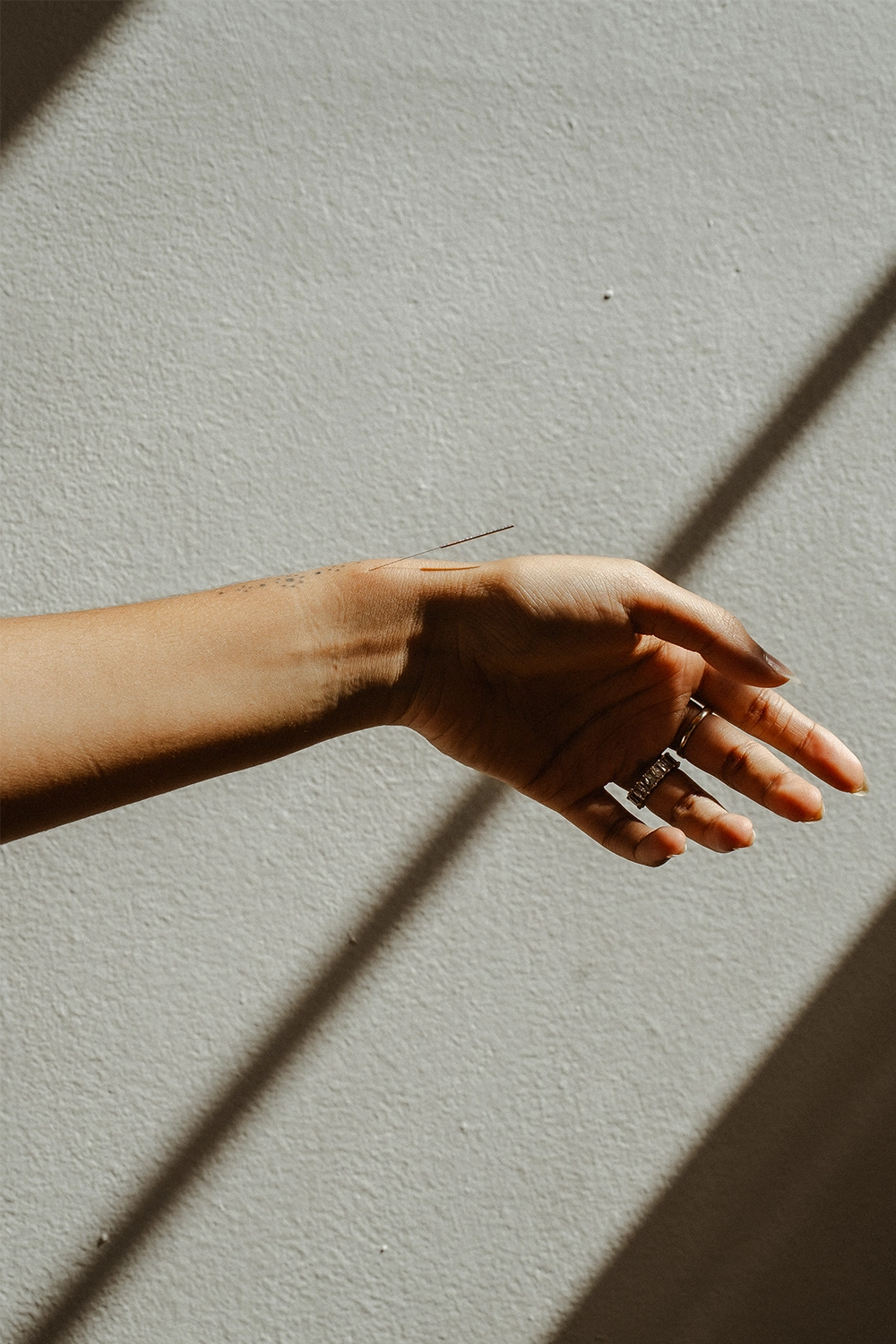 a hand with a acupuncture needle in it
