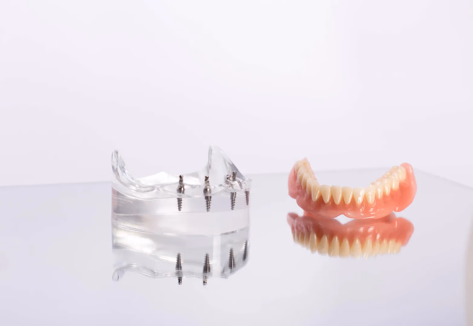 Is it worth replacing traditional dentures with full-arch dental implants?