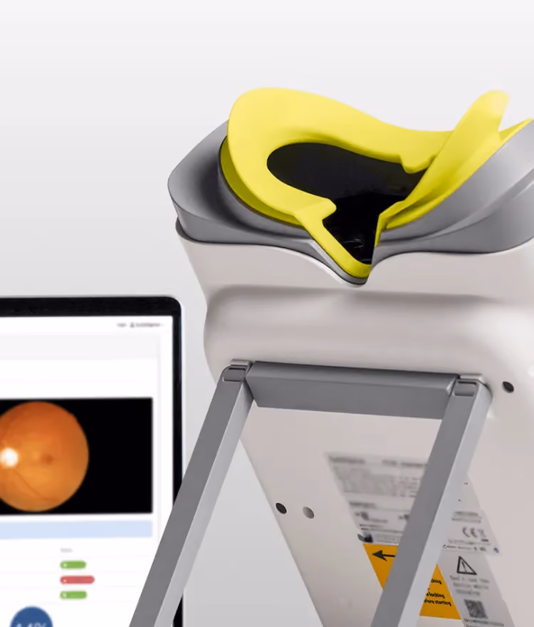 Close-up of a non-mydriatic retinal imaging device with a yellow forehead rest, positioned next to a computer screen displaying a retinal scan