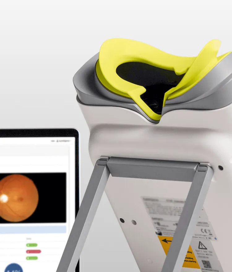 Close-up of a non-mydriatic retinal imaging device with a yellow forehead rest, positioned next to a computer screen displaying a retinal scan