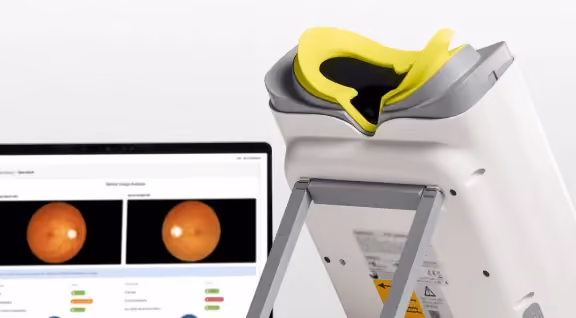 Close-up of a non-mydriatic retinal imaging device with a yellow forehead rest, positioned next to a computer screen displaying a retinal scan