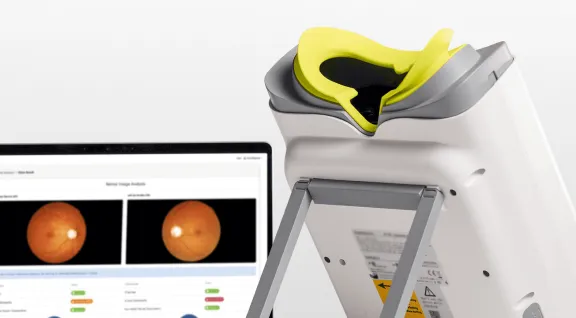 Close-up of a non-mydriatic retinal imaging device with a yellow forehead rest, positioned next to a computer screen displaying a retinal scan