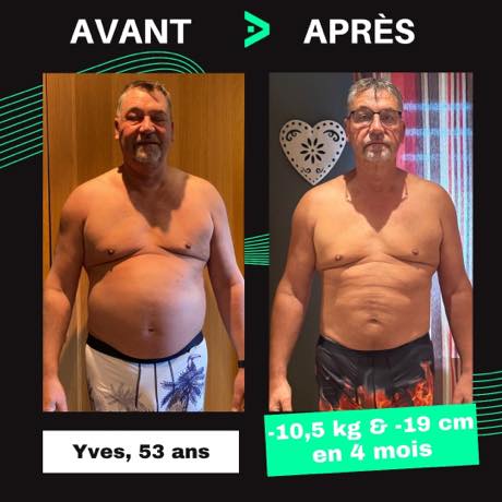 Transformation avant après