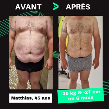 Transformation avant après