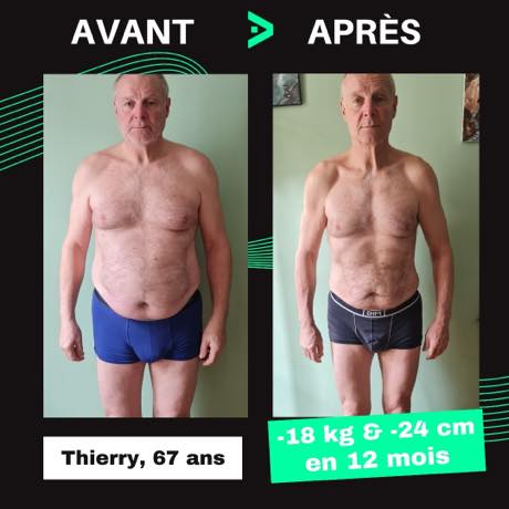 Transformation avant après