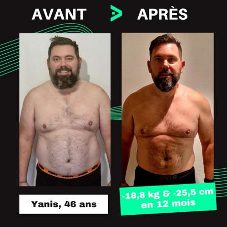 Transformation avant après