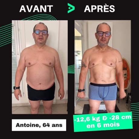 Transformation avant après