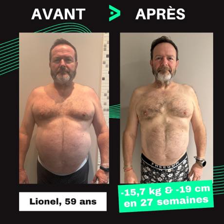 Transformation avant après