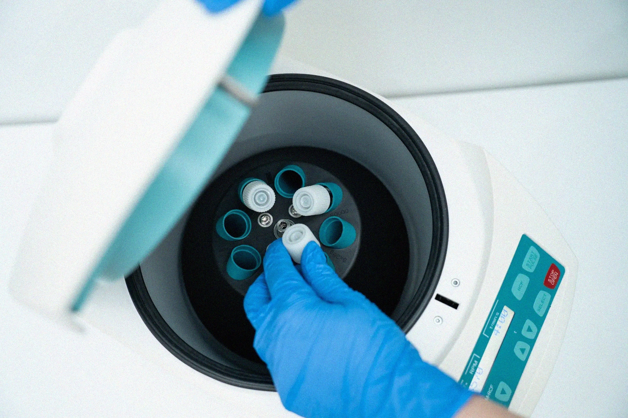 Preimplantation Genetic Testing (PGT): What It Is, Who Should Consider It, and What to Expect