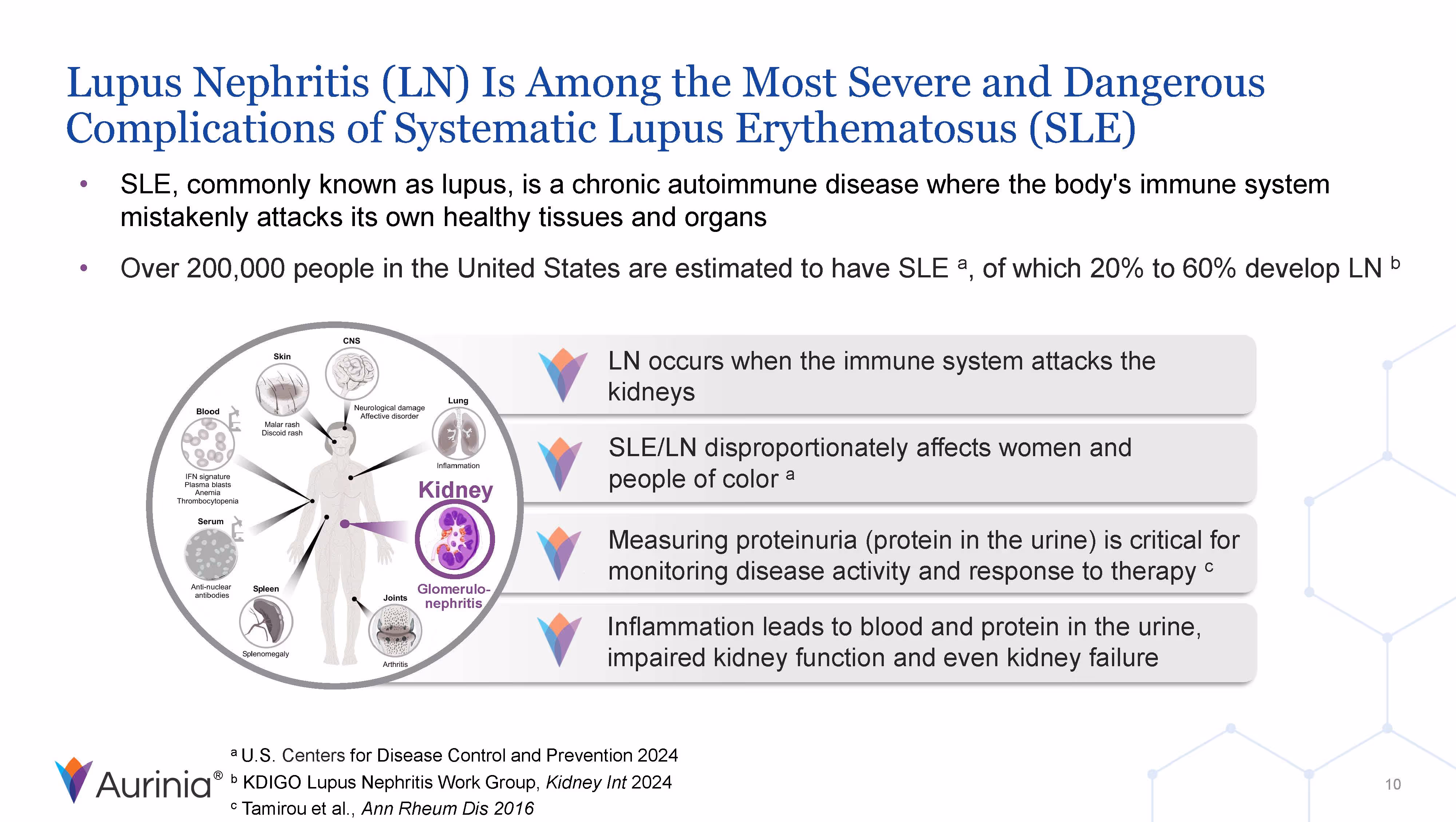 Lupus Nephritis (LN) Is Among the Most Severe and Dangerous Complications of Systematic Lupus Erythematosus (SLE)