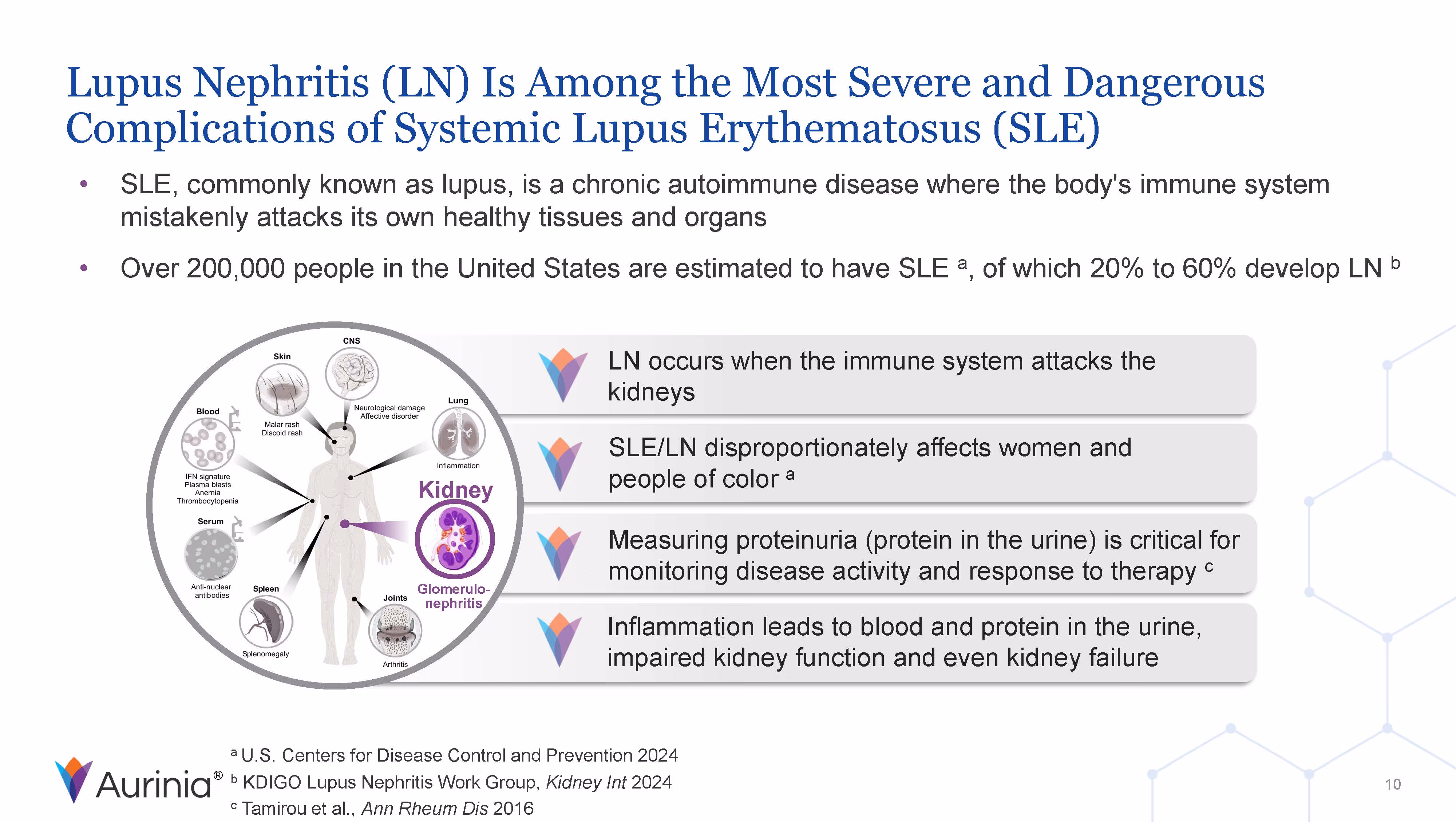 Slide explaining Lupus Nephritis (LN) as a severe complication of Systemic Lupus Erythematosus (SLE), including a diagram of organs affected and key facts about LN affecting kidneys, disproportionate impact on women and people of color, importance of measuring proteinuria, and consequences of inflammation.
